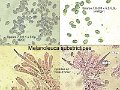 Melanoleuca substrictipes-amf81-2